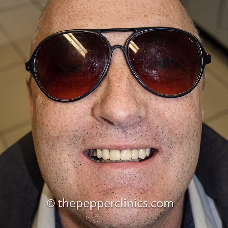 After treatment: a complete, even upper arch